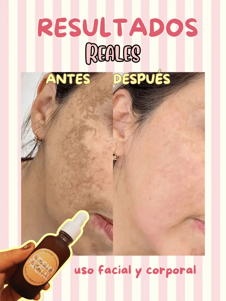 Acido ascorbico fantasia citrica skincare pequeño