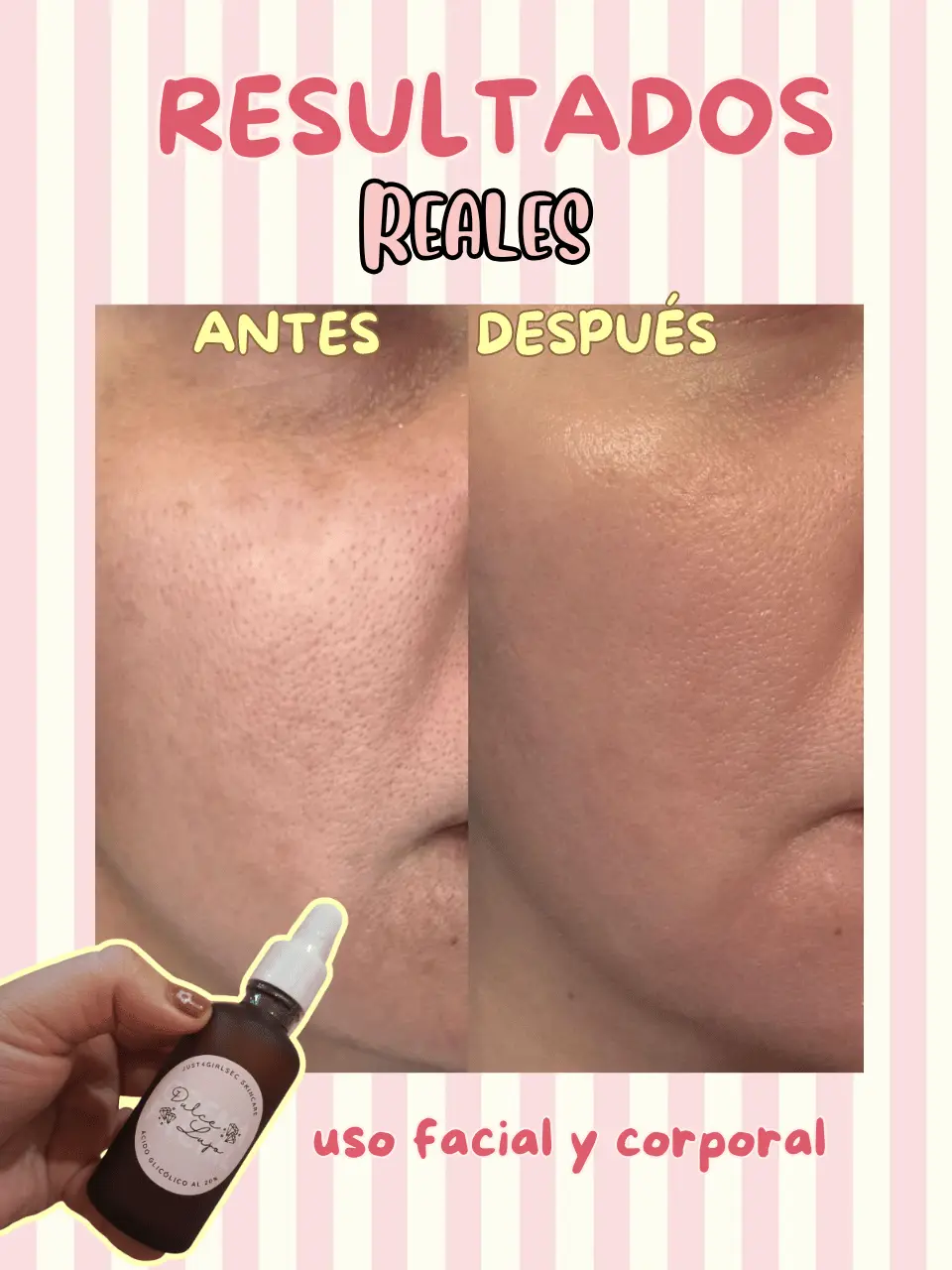 Acido glicolico dulce lujo