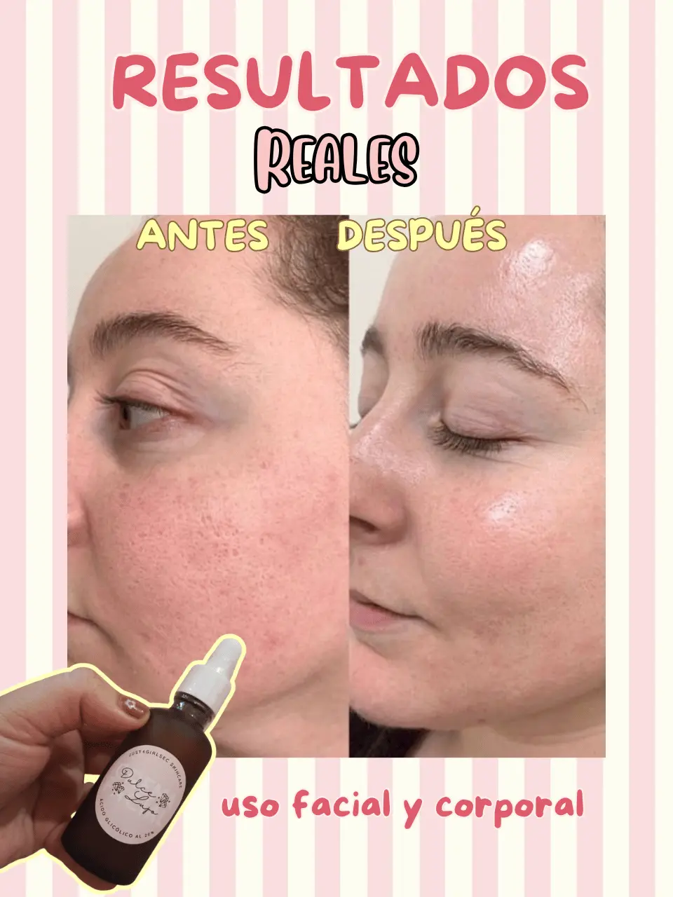 Acido glicolico dulce lujo