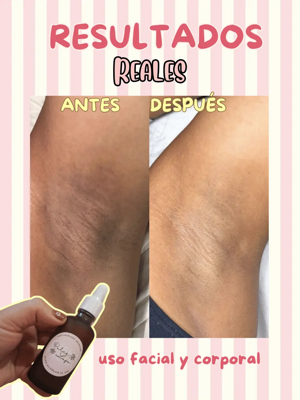 Acido glicolico dulce lujo
