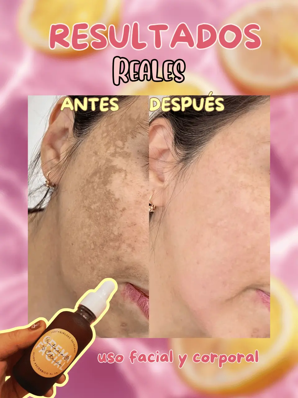 Acido ascorbico fantasia citrica skincare Grande